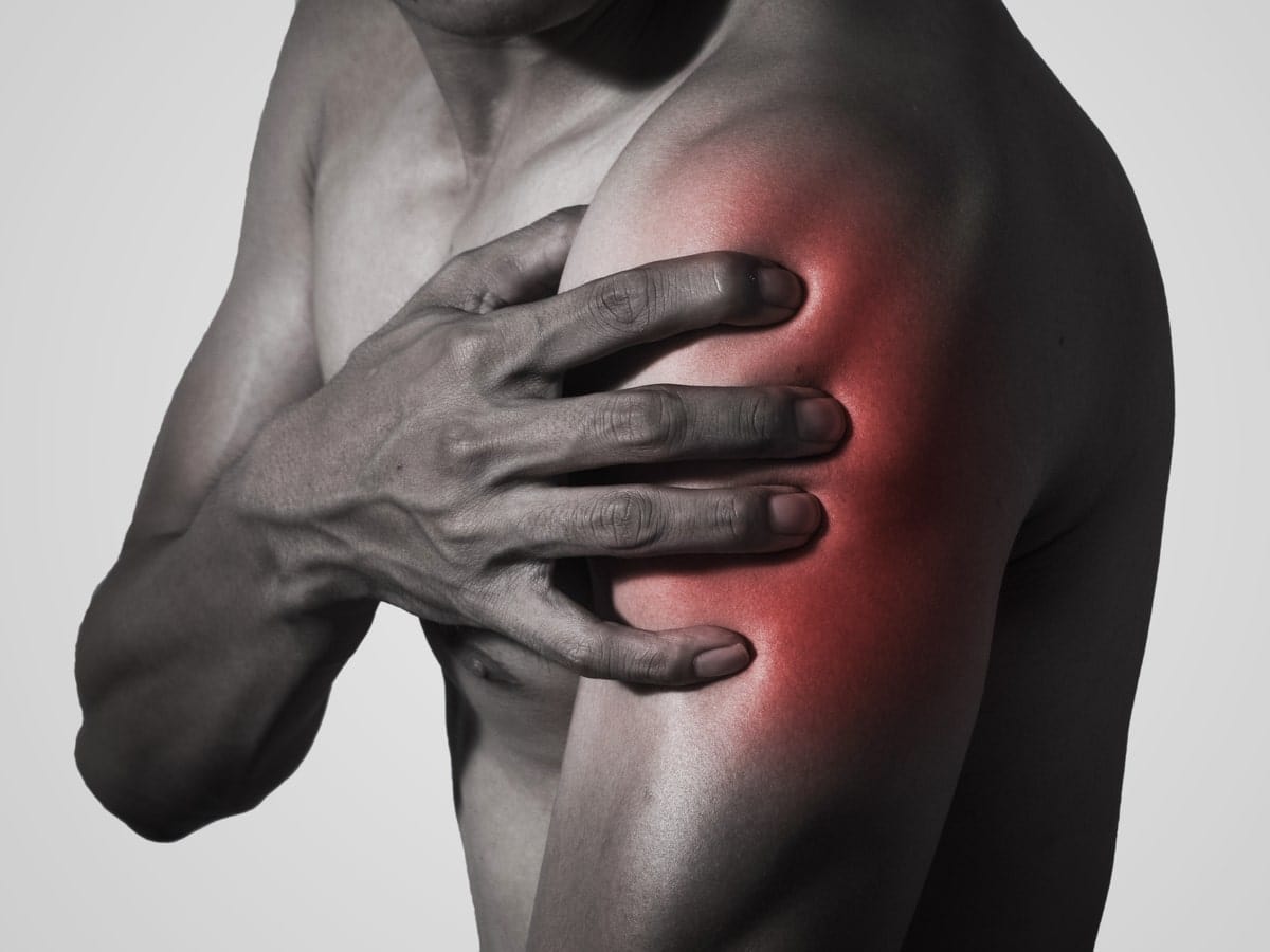 7 sintomas de Bursite do ombro Dr Rafael Patrocínio