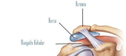 Ilustração da Tendinite do Ombro